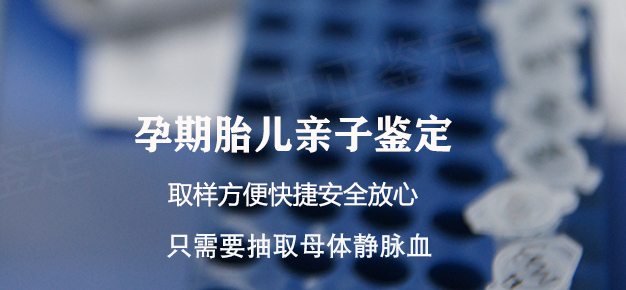 四川产前亲子鉴定办理费用,四川孕期亲子鉴定怎么做 四川产前亲子鉴定办理费用,四川孕期亲子鉴定怎么做