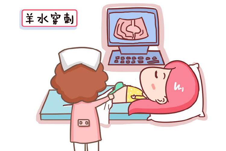 羊水样本采样方法 羊水样本采样方法